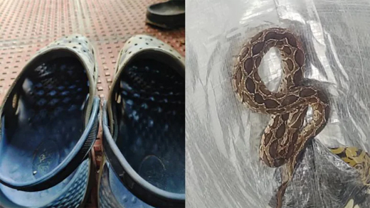 Snake bite